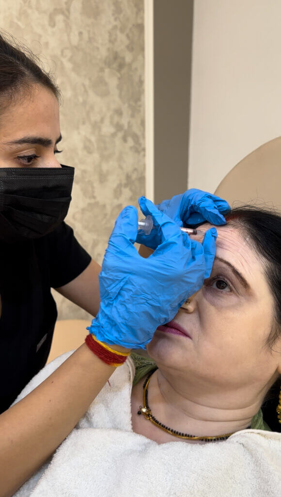 botox treatment