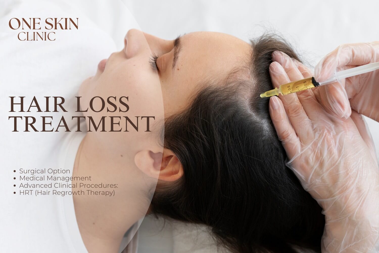 hair loss treatment near me