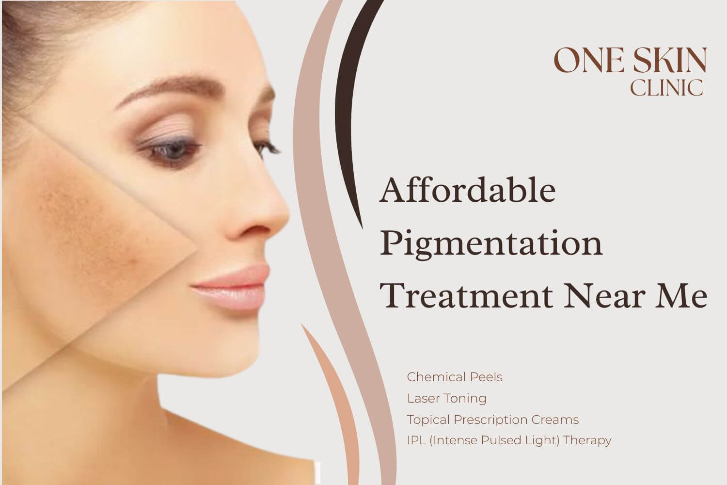 pigmentation treatment near me